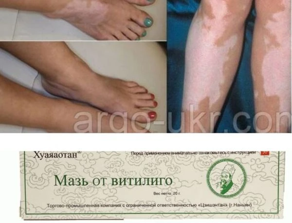 Хуаяаотан мазь от витилиго