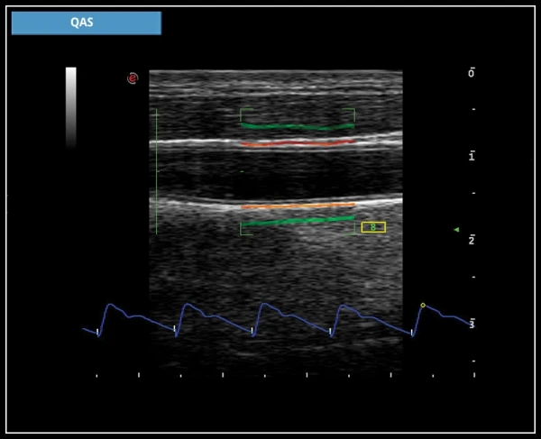 УЗИ аппарат Esaote MyLab X7
