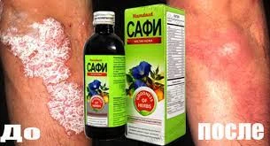 Сироп Safi против кожных заболеваний и для очистки крови (100 мг)