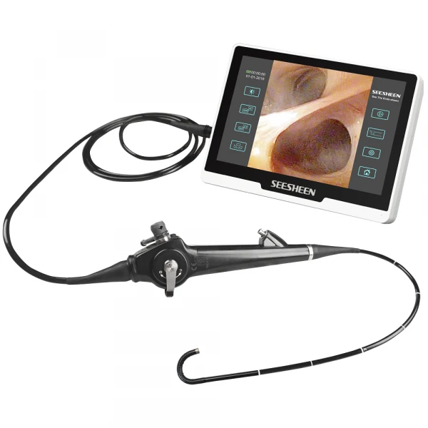 Gibkiy video xoledoxoskop