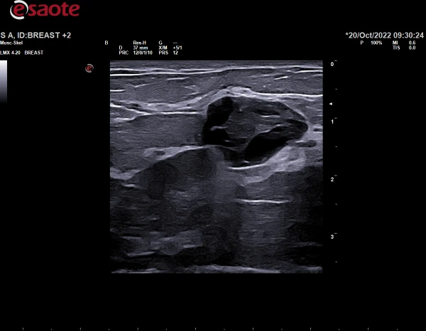 Ultrazvukovoy tomograf ESAOTE MyLab X90