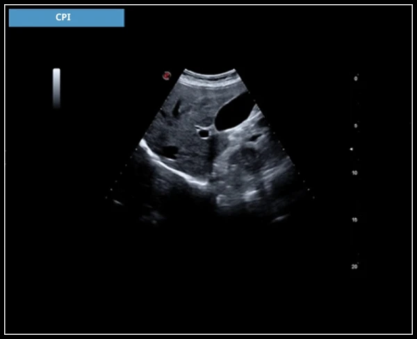 ESAOTE MYLAB X7 ekspert toifali ultratovush apparati