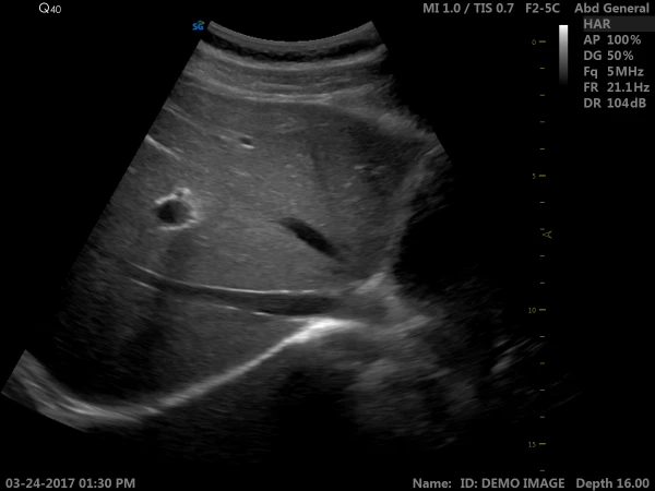 УЗИ-аппарат