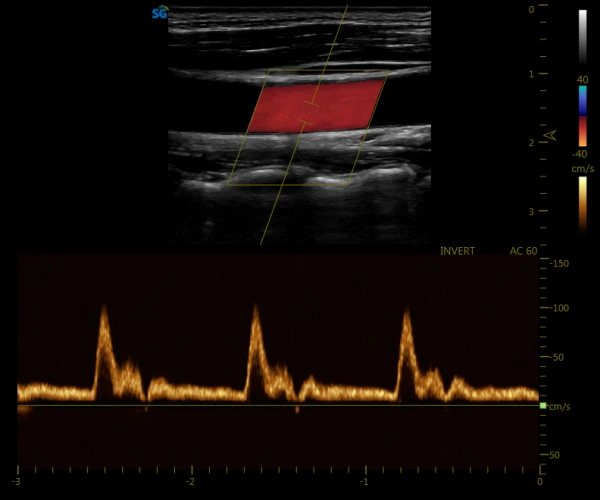 УЗИ-аппарат