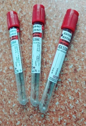 Vakuumli naychalar qizil rangda ivish faollashtiruvchisi 13x100 6 ml