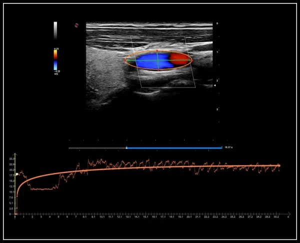 Ультразвуковой томограф нового поколения Esaote MyLab 9 eXp