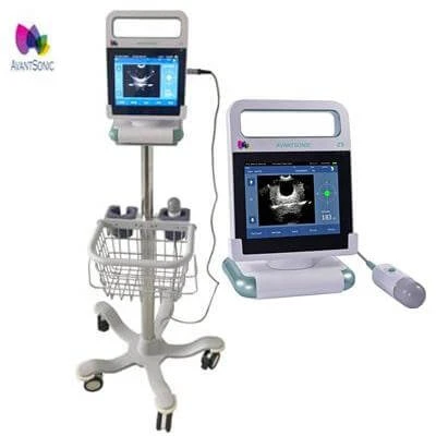 Skaner mochevogo puzirya model produkta:  AvantSonic Z5