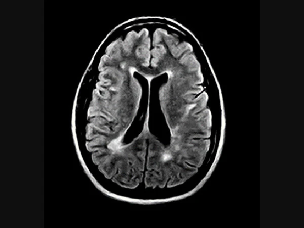 Поворотная система МРТ G-Scan