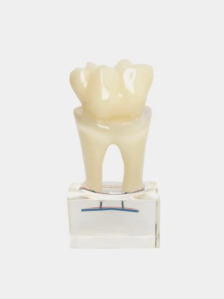 Mulyaj 6X tooth model with nerve