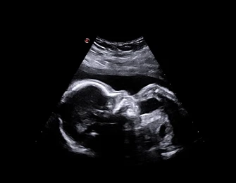 Esaote MyLab X75 universal ultratovush skaneri