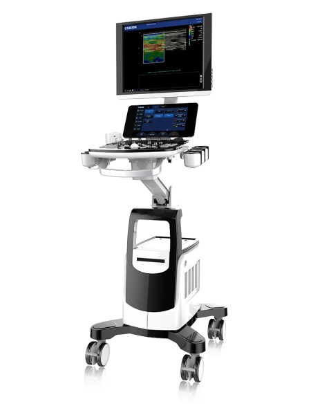 УЗИ - Ультразвуковая диагностическая система CHISON CBIT8