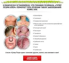 Krem Super Psori dlya uxoda za problemnoy kojey 100 ml
