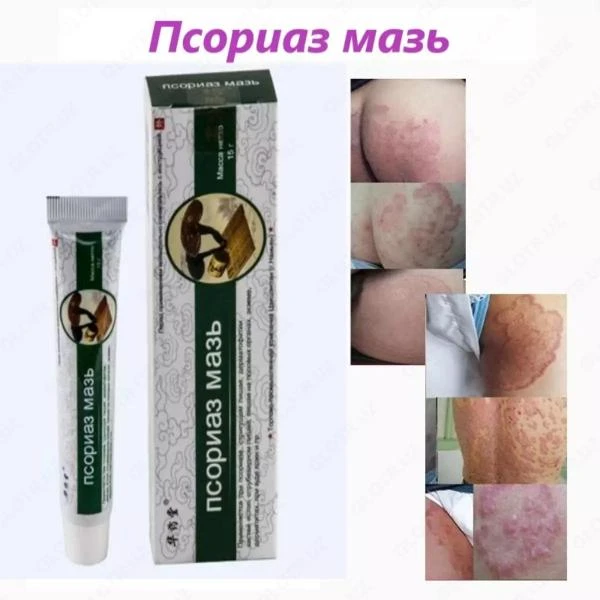 Мазь против псориаза