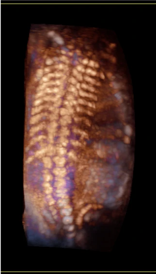 Esaote MyLab X5 ultratovush apparati