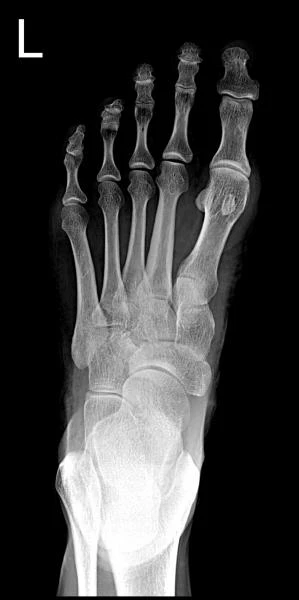 Sifrovoy rentgen apparat 6600