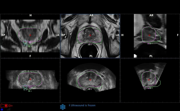 Ultrazvukovoy tomograf ESAOTE MyLab X90