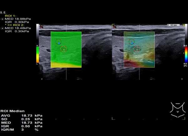 Ultrazvukovoy tomograf ESAOTE MyLab X90