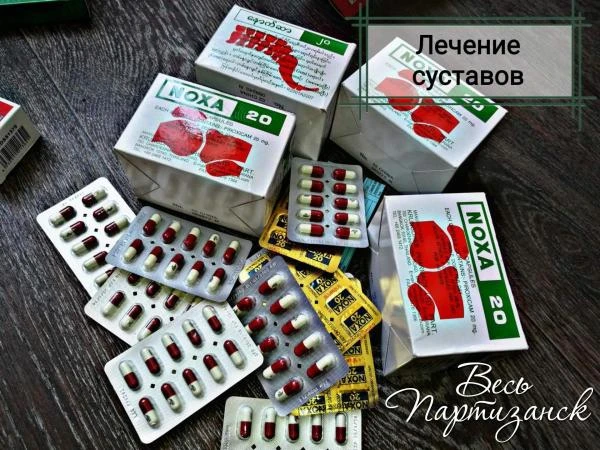 Капсулы NOXA 20 для лечения боли в суставах и позвоночнике