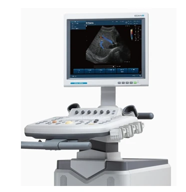 Ультразвуковая система (УЗИ) U2