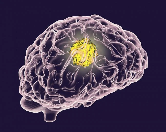 Evropada antiandrogen dori syproterondan foydalanishga cheklovlar o'rnatilmoqda