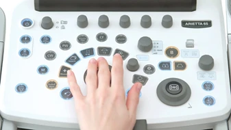 ARIETTA 65 ultratovush diagnostikasi qurilmasi