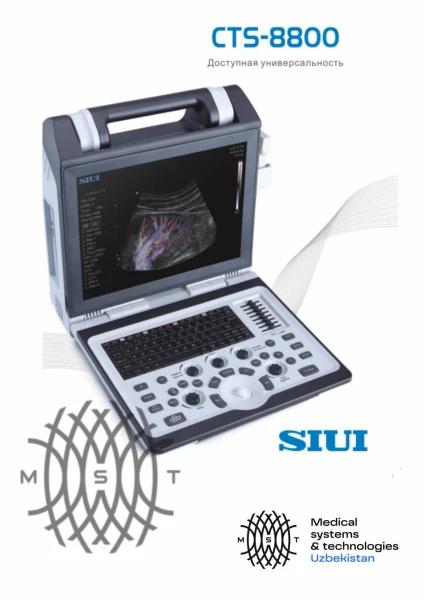 УЗИ-аппарат SIUI СTS 8800