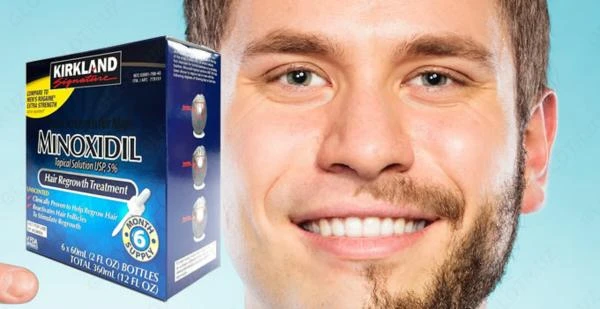 Soch to'kilishi uchun vositalar "Minoxidil Kirkland 5%"