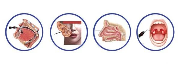Elektroxirurgicheskiy generator. Model: Sens AK-B250, AK-B300, AK-B400 (seriya B)