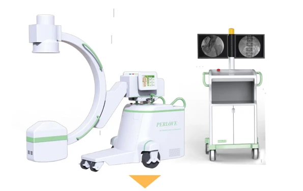 Visokochastotnaya mobilnaya rentgenovskaya sistema s-duga, 16kvt plx7000c