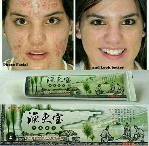 Maz «Sokrovishe ribaka» - ot psoriaza, dermatita, lishaya, zuda