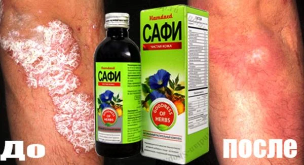 Сироп Safi против кожных заболеваний и для очистки крови (100 мг)