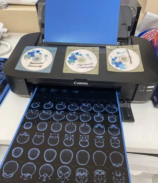 Плёнки для Рентген, МСКТ, МРТ размер 33х43