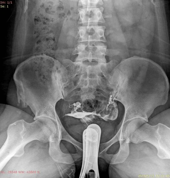 Sifrovoy rentgen apparat DR 6600 US-ARM