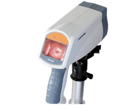 Цифровой видеокольпоскоп