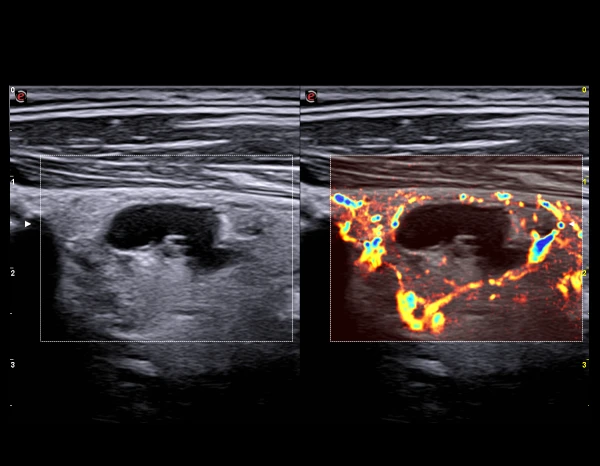 Esaote MyLab X75 universal ultratovush skaneri