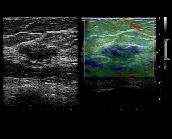 Ультразвуковой томограф нового поколения Esaote MyLab 9 eXp