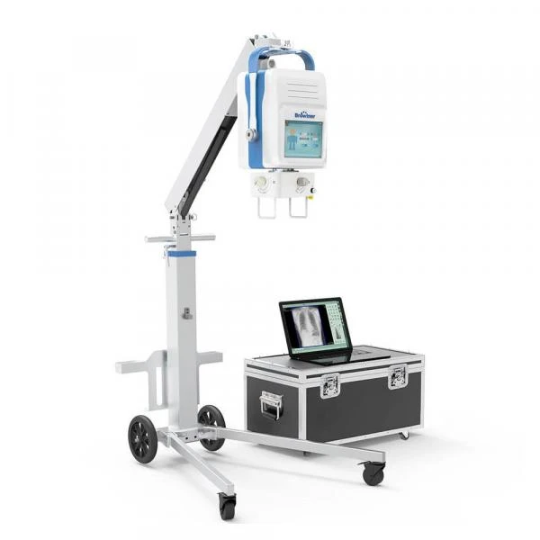 Sifrovoy rentgen apparat Beatle-05P