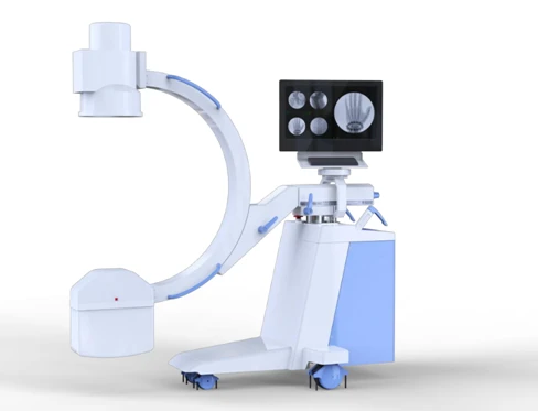 Visokochastotnaya peredvijnaya sistema tipa s-duga, 3.55kvt plx116a1