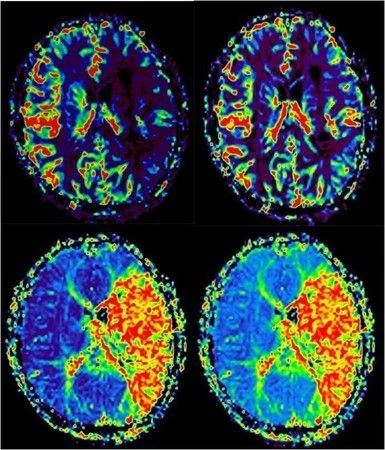 Магнитно-резонансная томография (МРТ) NSM-S15 1.5T