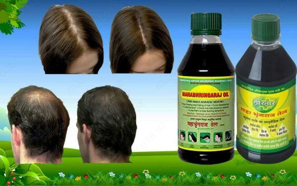 Soch to'kilishini davolash Kirkland Minoxidil 5%