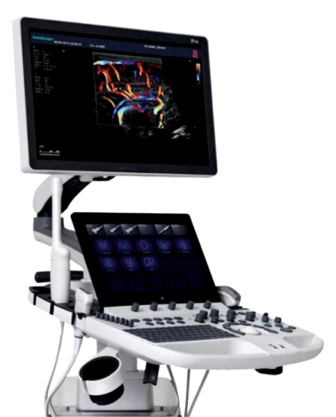 Система ультразвуковой диагностики  Модель: SonoScape P-50