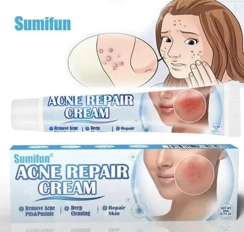 Крем от угрей Sumifun