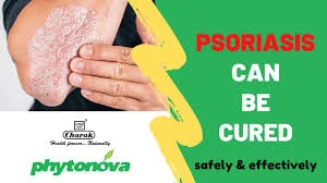 Имупсора (Imupsora) от псориаза и кожных заболеваниях