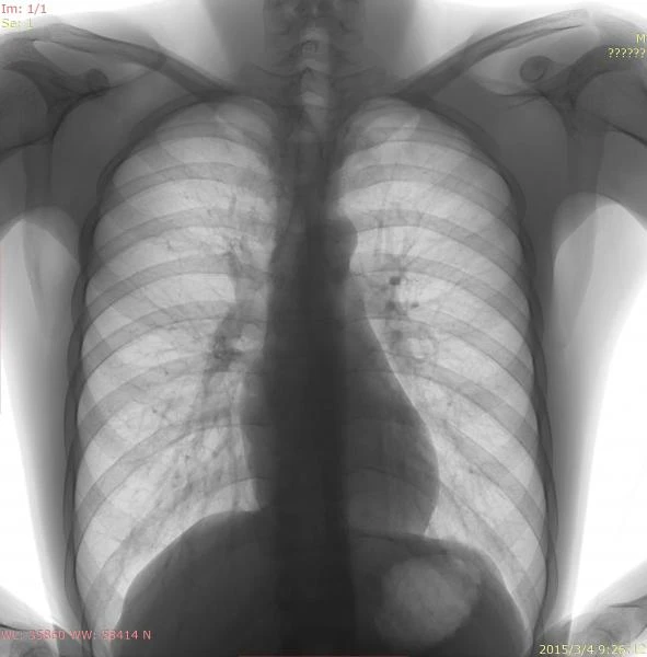 Sifrovoy rentgen apparat DR 6600 US-ARM