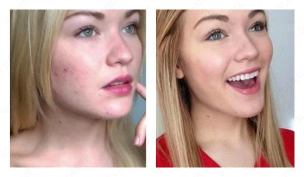 Станция выделения Нуклеиновых Кислот типа (типа Allsheng)