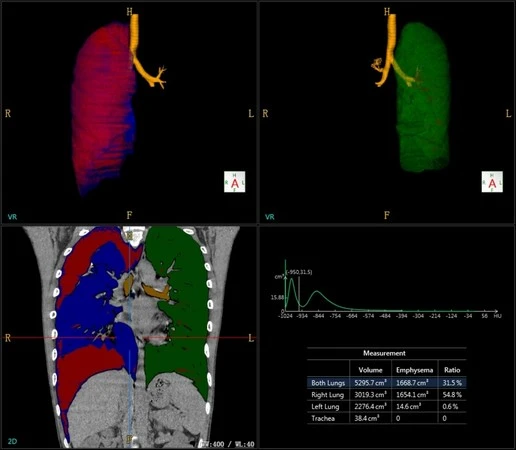 Компьютерная томография (КТ) NeuViz 16 Classic