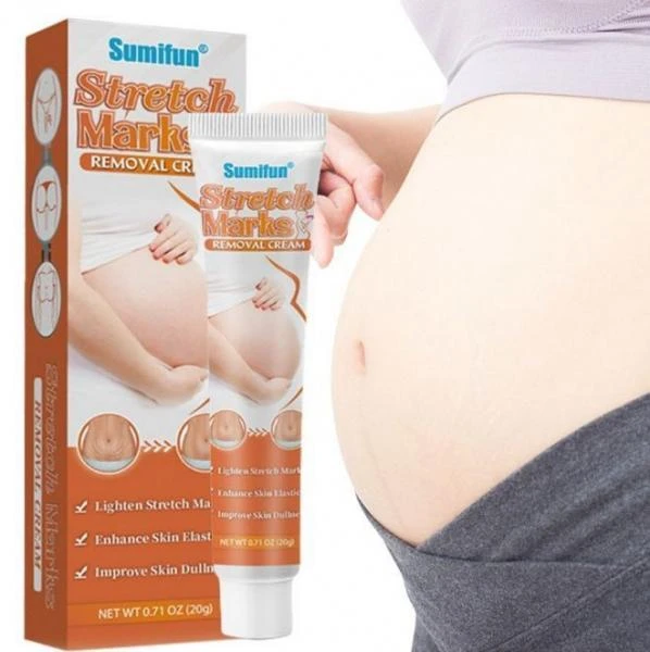 Sumifun Stretch Marks Cream 20 g strech belgilari uchun krem
