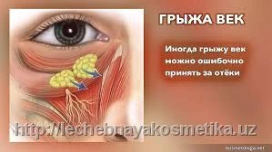 Супер крем для глаз от отеков и синяков