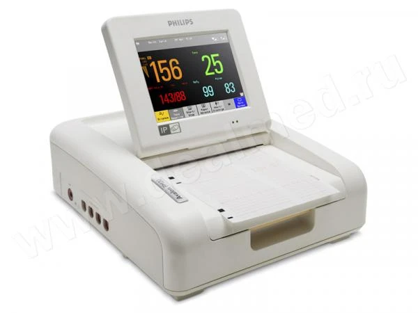 Fetalniy monitor materi i ploda STAR5000S