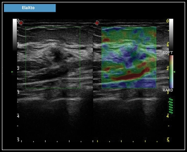ESAOTE MYLAB X7 ekspert toifali ultratovush apparati